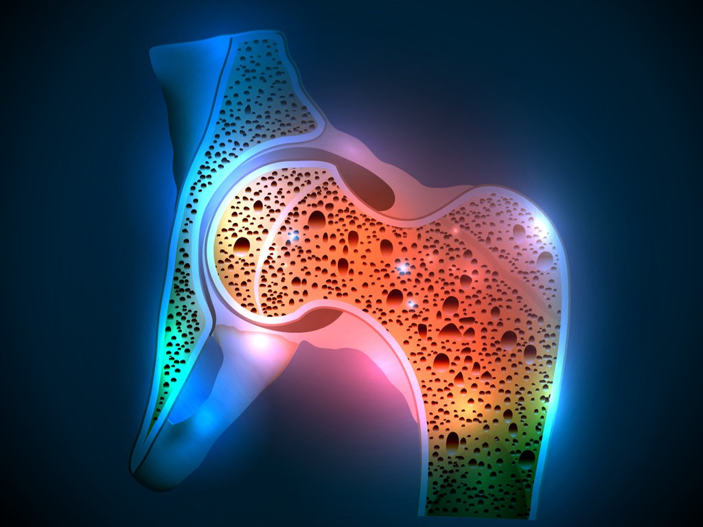Bone Density VS. Bone Quality — Is there a difference? Biology Diagrams